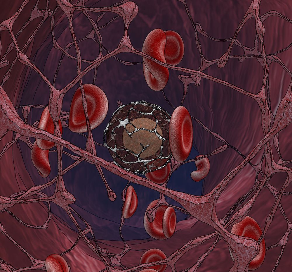 기본 프로젝트 커버 이미지