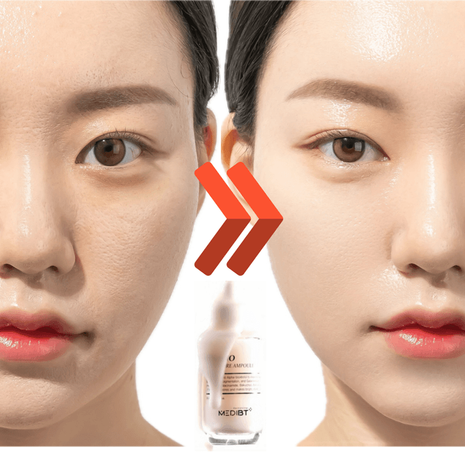 기본 프로젝트 커버 이미지